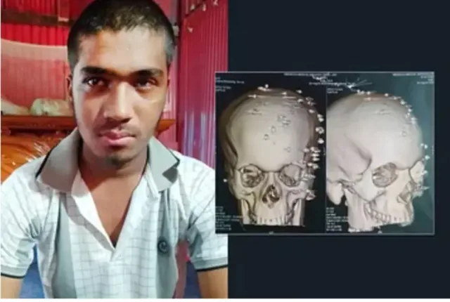 mathar khuli